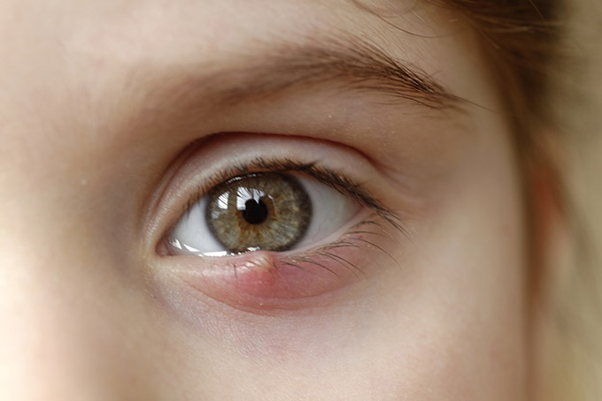 ET-stye.jpg